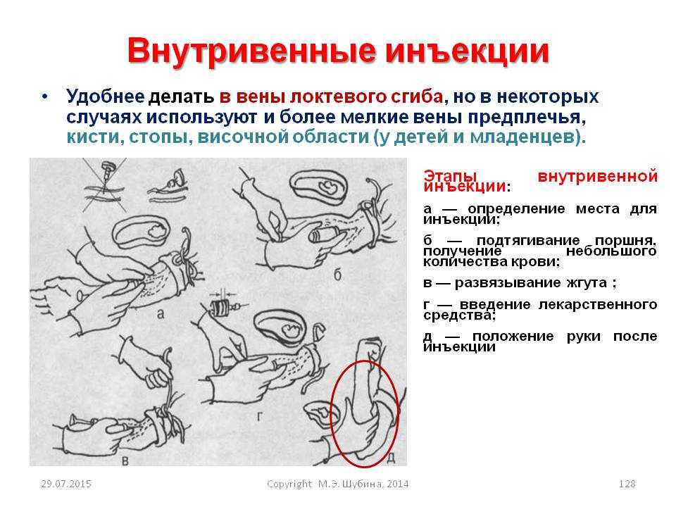 Алгоритм внутривенной инъекции. Внутривенное Введение лекарственных средств алгоритм. Внутривенная инъекция места введения лекарственных препаратов. Внутривенная инъекция алгоритм выполнения. Места постановки внутривенной инъекции.