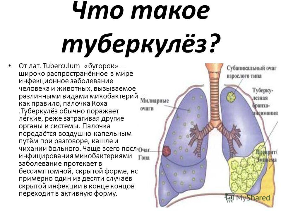 Закрытая форма